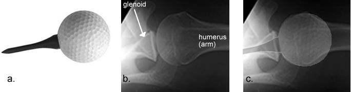 Shoulder Anatomy